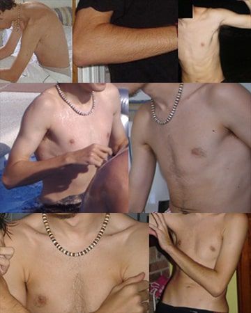 cuerpo ectomorfo